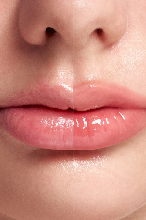 Intense lip plumper with microneedles Reedle Shot Lip Plumper Expert, 4,3 gIVET.PL - Modna odzież
