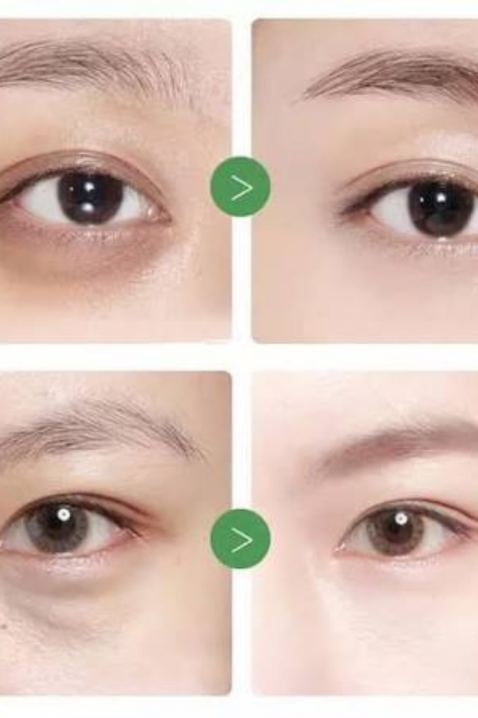 Mary&May Tranexamic Acid + Glutathion Eye Cream, 30 gIVET.PL - Modna odzież